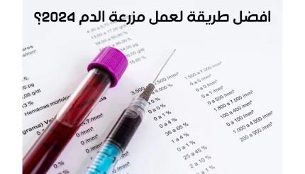 افضل طريقة لعمل مزرعة الدم 2024؟