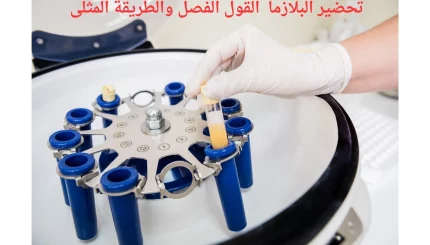 كيفي الفصل بشكل فعال للحصول على بلازما غنية بالصفائح"